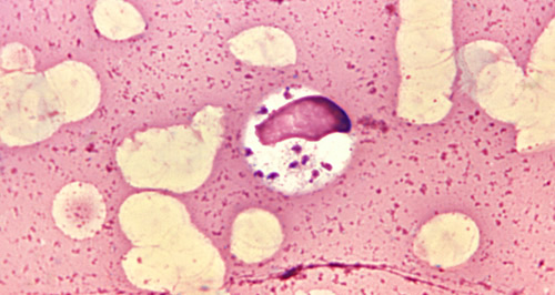 Celulas leishmaniosis